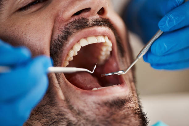 Best Emergency Dental Care for Broken or Chipped Teeth in Winter Haven, FL